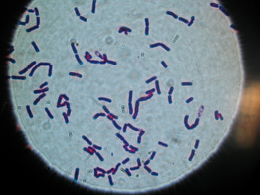 Bacillus cereus