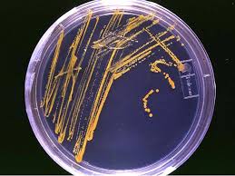 The Role of Bile Salts in Microbial Culture Media