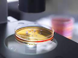 Pseudomonas aeruginosa ATCC 27853: A Standard Strain for Microbiology Research and Quality Control