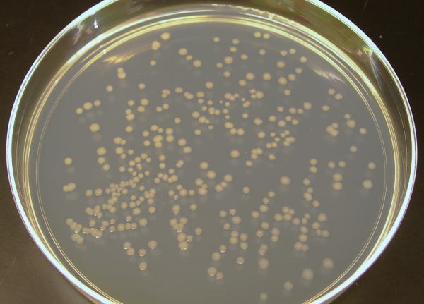 Why Are Agar Plates Incubated Upside Down After Inoculation?